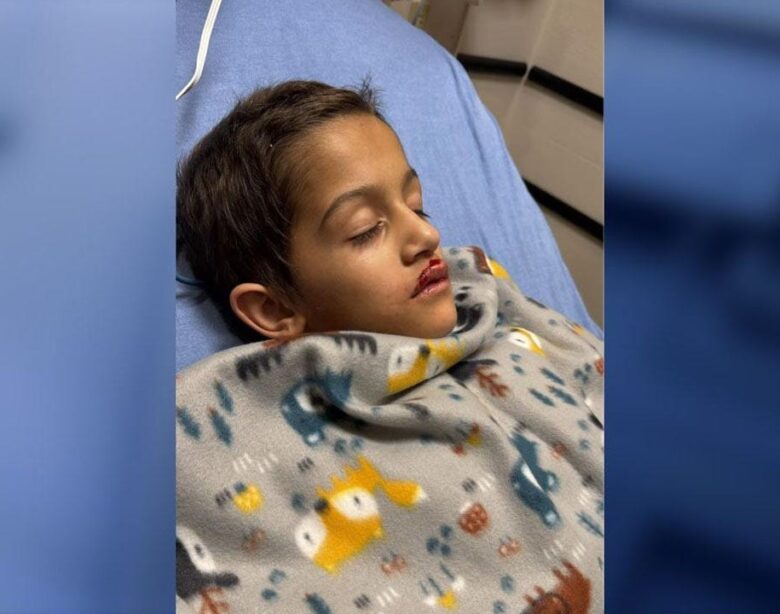 Florida boy undergoes heart surgery after being attacked by a drone at a holiday display.